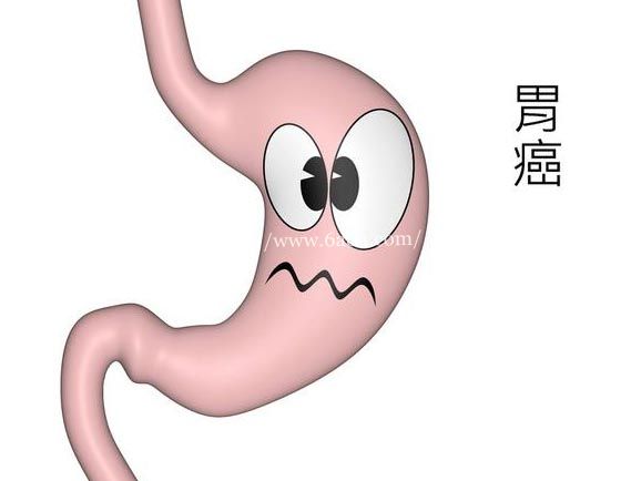 回顾2016：胃癌领域四大治疗方式研究进展